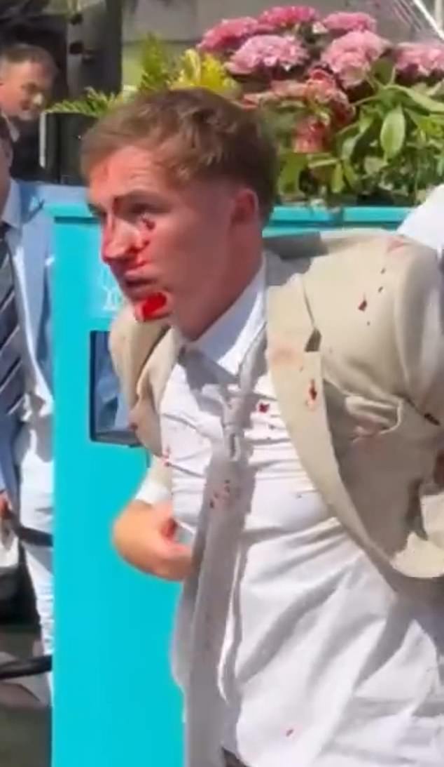 The bloodied racegoer wipes his visage and bloodies his cream trousers as he seemingly yells at man he had fought only moments before