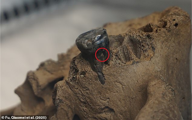 Scientists extracted DNA from the plaque on one of Dragon Man's teeth which contained traces of cells from inside his mouth. This DNA matched samples taken from Denisovan bones