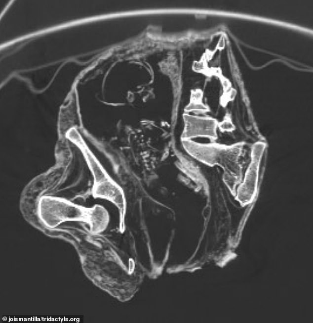 The mystery surrounding the bizarre ' alien ' mummies found in Peru has deepened after scientists said they discovered a fetus inside the womb of one of the 'corpses'. CT scans (pictured) captured the fetus lying on its back