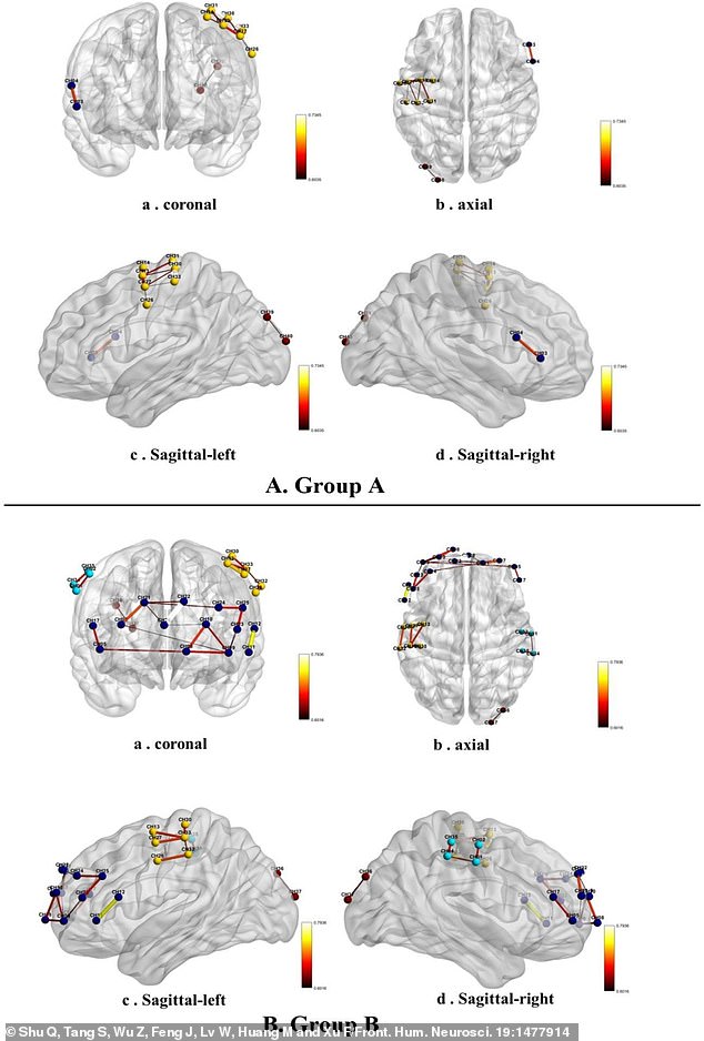 Low-frequency users demonstrated stronger connectivity in brain regions involved in language processing, movement coordination and sensory input. While the high-frequency users showed increased connectivity in areas associated with executive functions