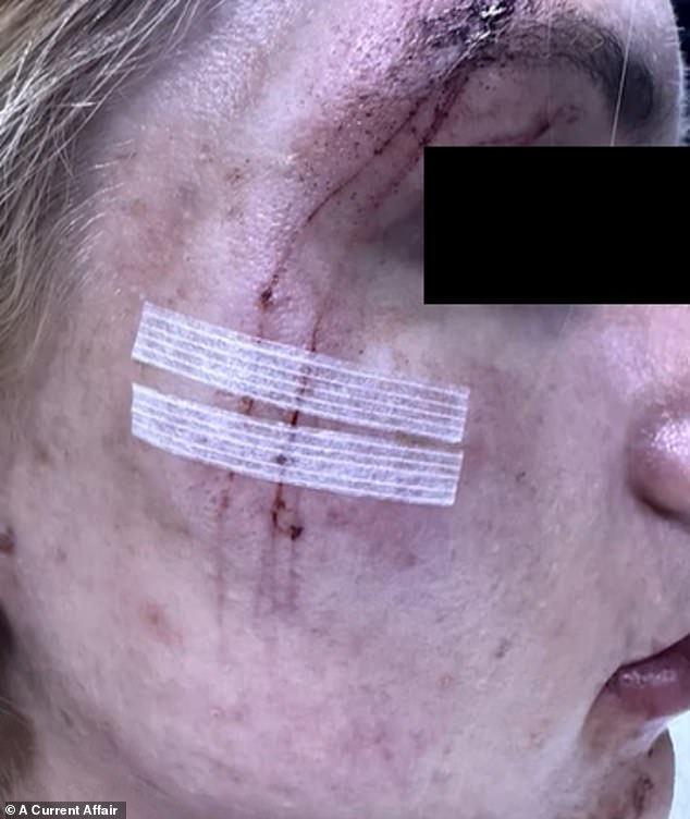She claimed that she was attacked and 'absolutely beaten up' by three men while heading home from the gym one evening