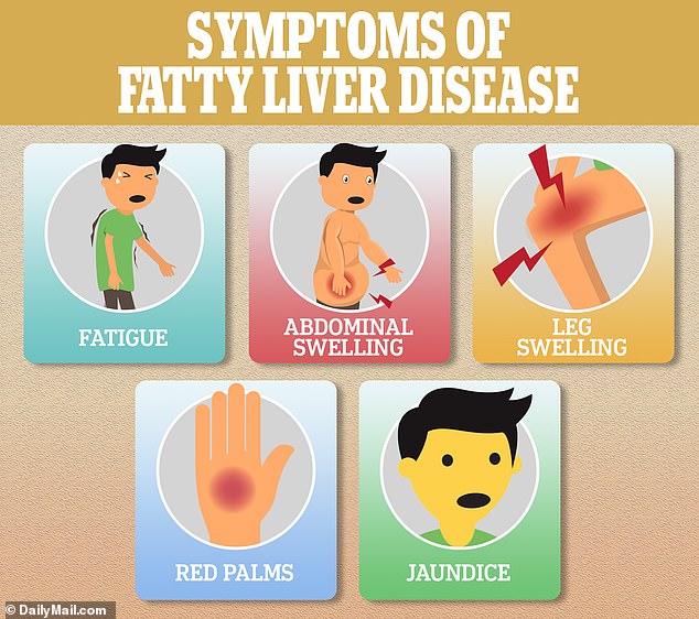 Symptoms of fatty liver disease can be difficult to notice at first, other than fatigue. However, as the disease progresses, symptoms such as swelling, red palms, and jaundice appear
