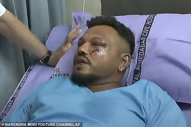 Vishwash Kumar Ramesh, sole survivor of the Air India flight 171 crash, at a hospital in Ahmedabad. He says the plane's lights flickered and it felt 'stuck' and unable to ascend