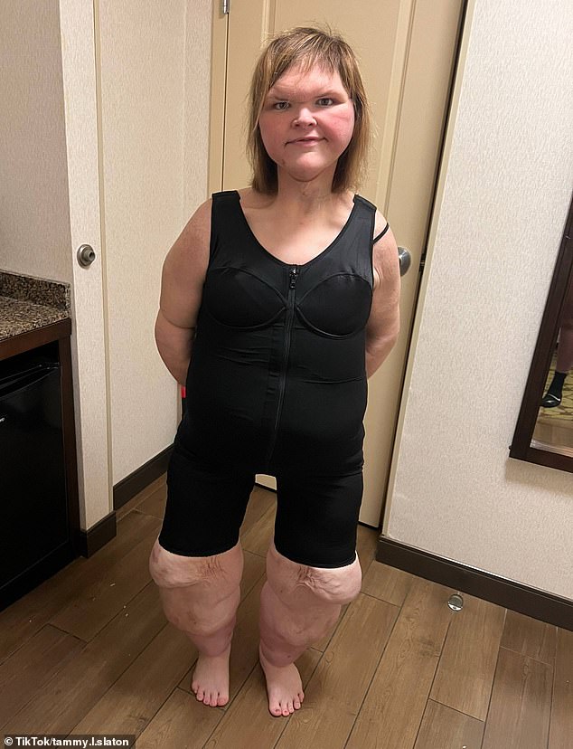 Tammy Slaton left fans stunned with her dramatic transformation in a TikTok photo carousel posted Tuesday