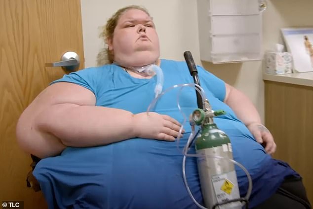 The reality star underwent bariatric surgery in late 2022 followed by skin removal procedures; (seen in 2022)