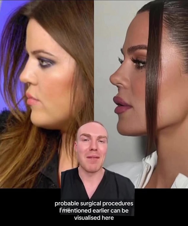 Fresh off her appearance at Jeff Bezos and Lauren Sánchez¿s star-studded wedding in Italy , Khloe earned a glowing shout-out from London-based aesthetician Dr. Jonny Betteridge, who called her the 'standout face' of the event