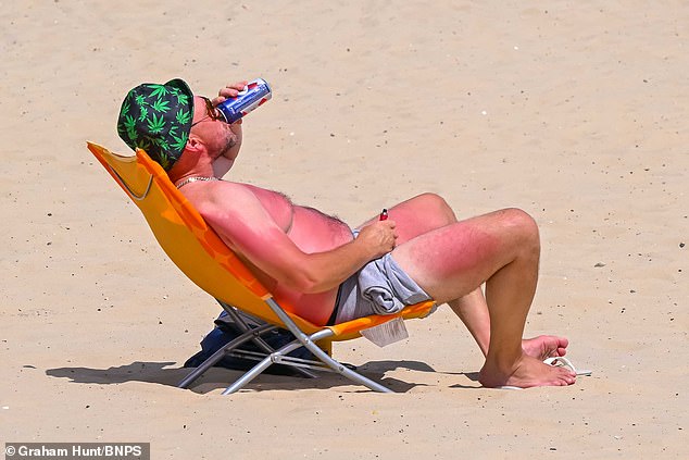 A sunbather on the beach at Weymouth in Dorset yesterday afternoon showing signs of sunburn - do YOU know who he is? Email tips@dailymail.com