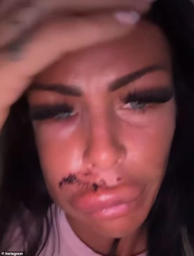 The 31-year-old was savaged after she tried to stroke the dog during a night out