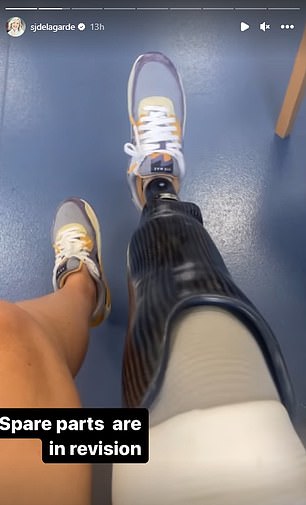 Sarah de Lagarde's prosthetics