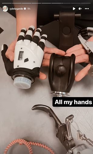Sarah de Lagarde's prosthetics