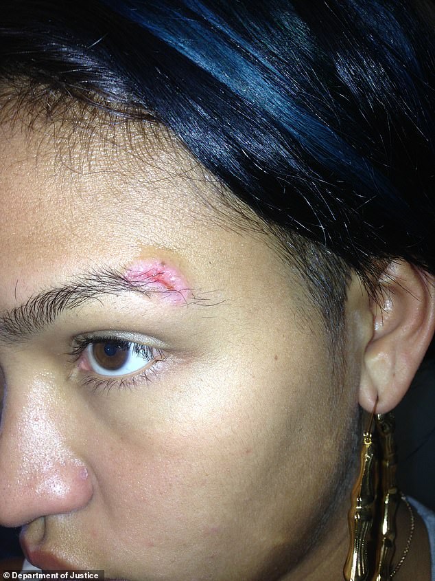 Cassie is seen with a gash on her eyebrow in evidence photo