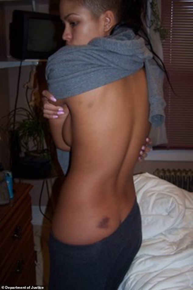 Cassie also showed images of her bruises that she alleged were inflicted by the rapper