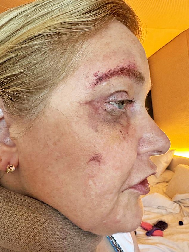 Photographs of Ms Giuffre in hospital were purportedly been taken in January, two months before Ms Giuffre claimed on social media a car accident had left her with 'four days to live'