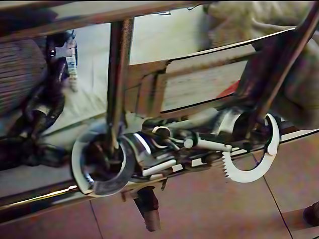 Cheng's shackles are seen on his hospital bed hours after he was operated on in China
