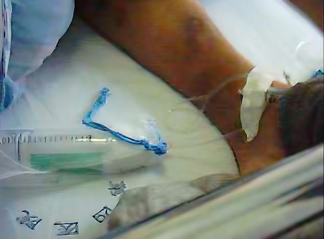 IV lines are seen snaking into Cheng's body following his forced surgery in 2004