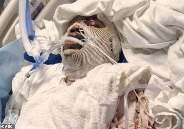 Sheffield is expected to be in the hospital for six months. His sister said he looked like a 'zombie' after the rescue