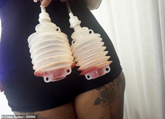 Chloe had drains on her boobs which she had to empty every day after surgery