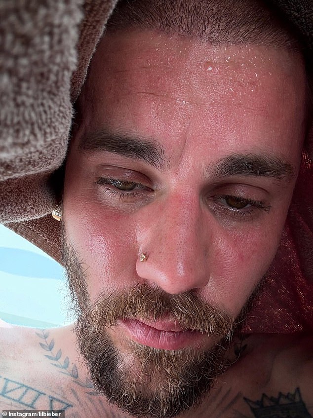 The Peaches singer, 31, shared five photos and captioned them 'Detoxxxxxxxxxxx'