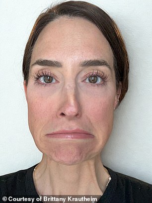 Brittany has been documenting the endeavor on TikTok , where her videos have racked in millions of views. She's seen before the injections