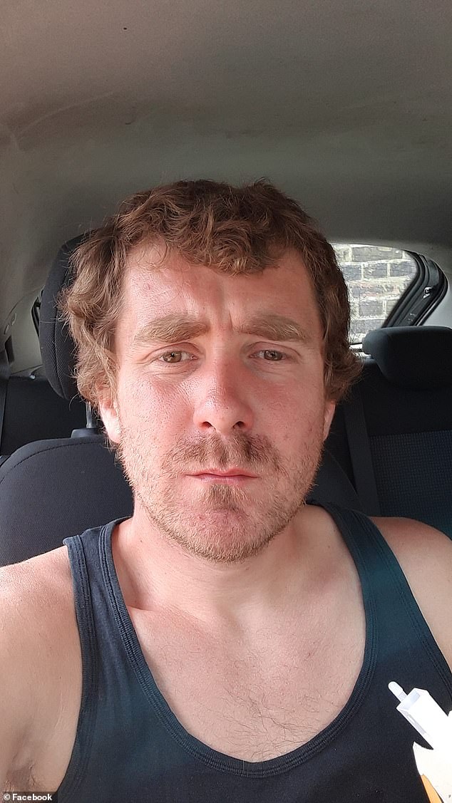 According to his half brother, Liam, O'Meara's main injuries were caused by the dropping of the chainsaw, as he believes his brother may lose use of his arm