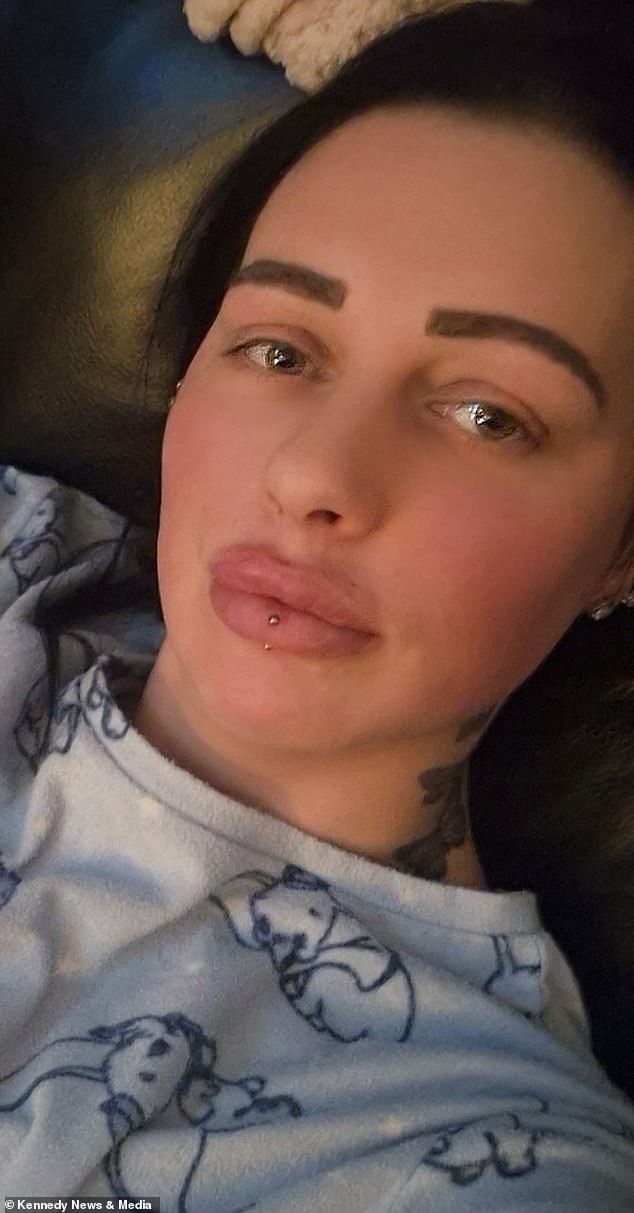 According to Amy, the damage was not permanent. However, she is sharing her story in the hopes of spreading awareness