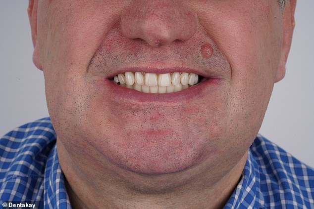 Mr Lakey loves how natural his teeth look after having dental implants