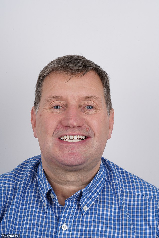 Mr Lakey is thrilled with the results, and after years of shame loves to smile and laugh freely