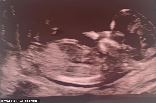 The family said: 'She had a passion for life and her family and was particularly looking forward to being a grandma to her newly born granddaughter, April Rose'