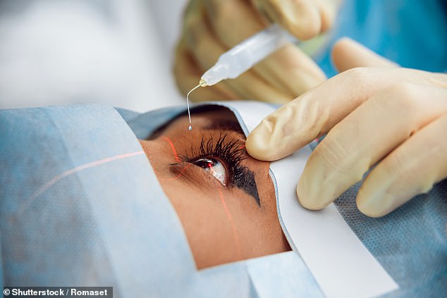 Cataract surgery involves the process of swapping the eye¿s cloudy lens out for a clear artificial lens