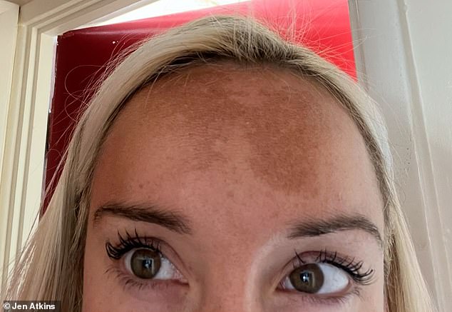 Jen now takes better care of herself regarding sun care, fake tanning instead of using sunbeds and wearing suncream outside