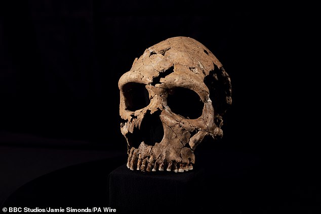 Neanderthals shared changes in brain shape also found in people suffering from the headache-causing Chiari malformations. Pictured: A 75,000-year-old Neanderthal skull known as Shanidar Z