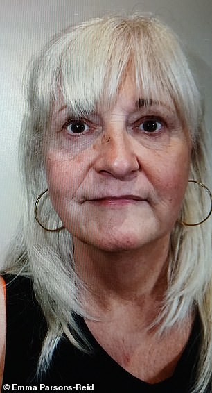 Emma In November 2024 prior to having filler on her marionette lines