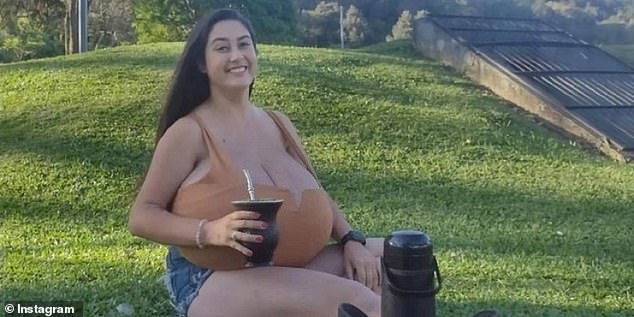 Marcondes is pictured above before the surgery. Her breasts were growing by about 3.2lbs every month