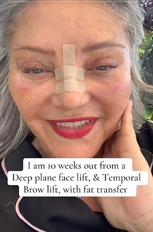 The grandmother's jawline is more defined now