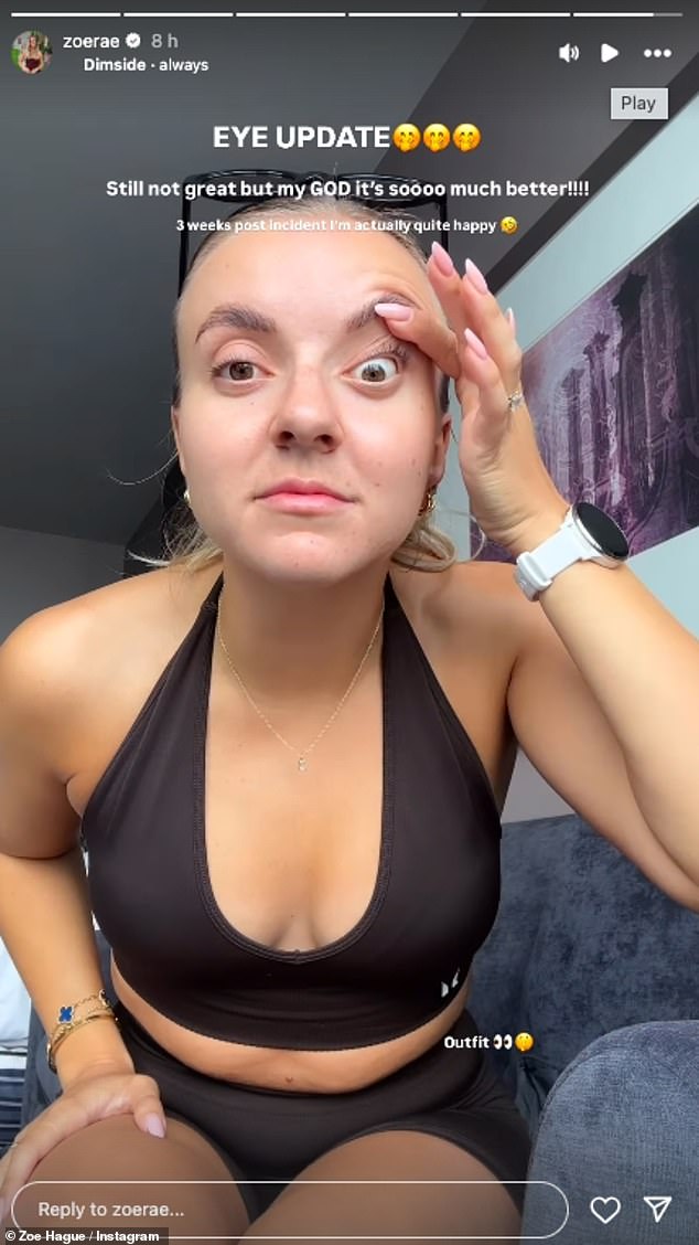 It comes after Zoe gave her followers an update on her botched Botox in a new clip posted to her Story