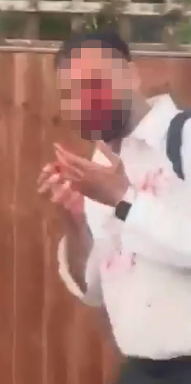 A man appeared to have blood all over his face following the disorder outside the hotel