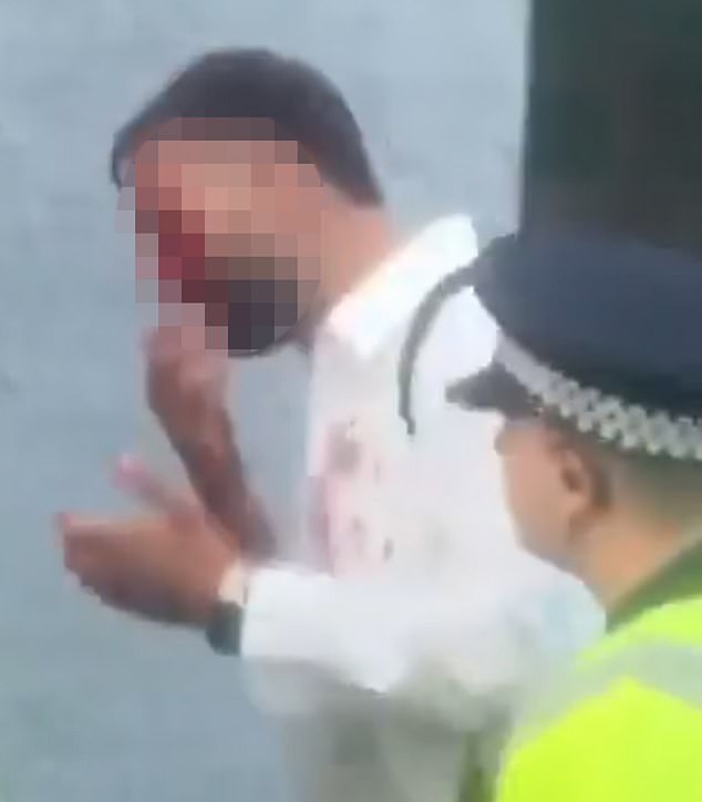 One man was seen with a nasty cut on his head and blood on his top as he walked past police following the disorder