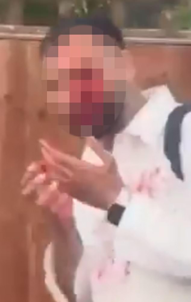 A man appeared to have blood all over his face following the disorder outside the hotel