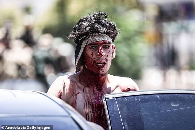 An injured man is seen as clashes continue for the fourth day between Syrian security forces and armed local groups, in Suwayda, Syria, on July 16, 2025