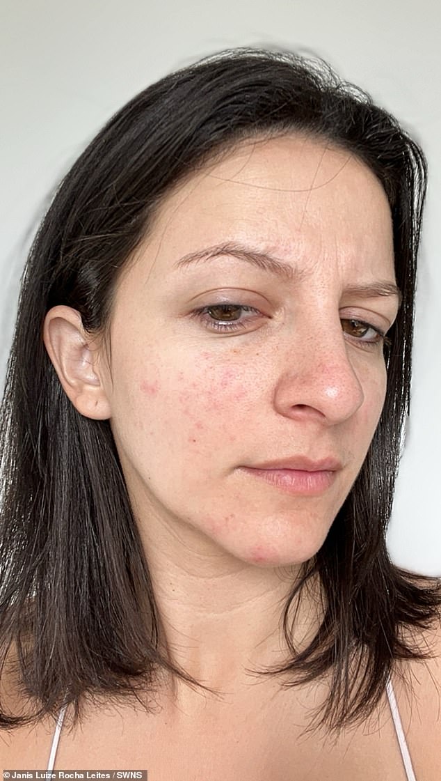 Janis Luize Rocha Leites, 30, from California , had tried various diets including spending two years as a vegetarian . However, she wasn't feeling her 'best self' and was struggling with 'small red dots' on her skin, a lack of energy, and hair fall