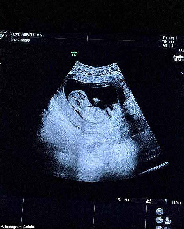 Further images showed the couple dressed in white celebrating the pregnancy, a scan of their unborn child and attending an ultrasound appointment