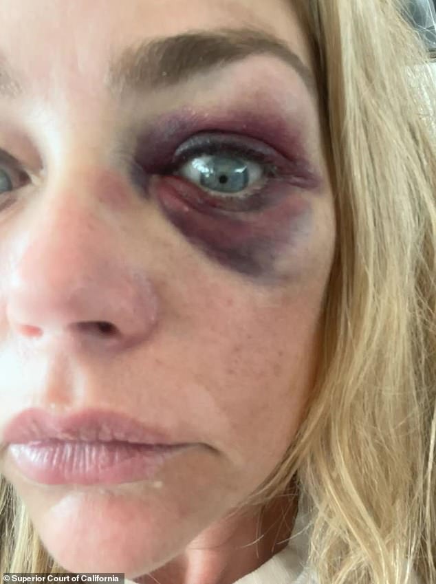 During the alleged assault, Richards claimed her estranged husband called her a "f*****g b***h and that the incident was witnessed by a family member