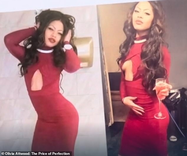 Chelsea (pictured before receiving any cosmetic surgery procedures) had her first boob job at the 18