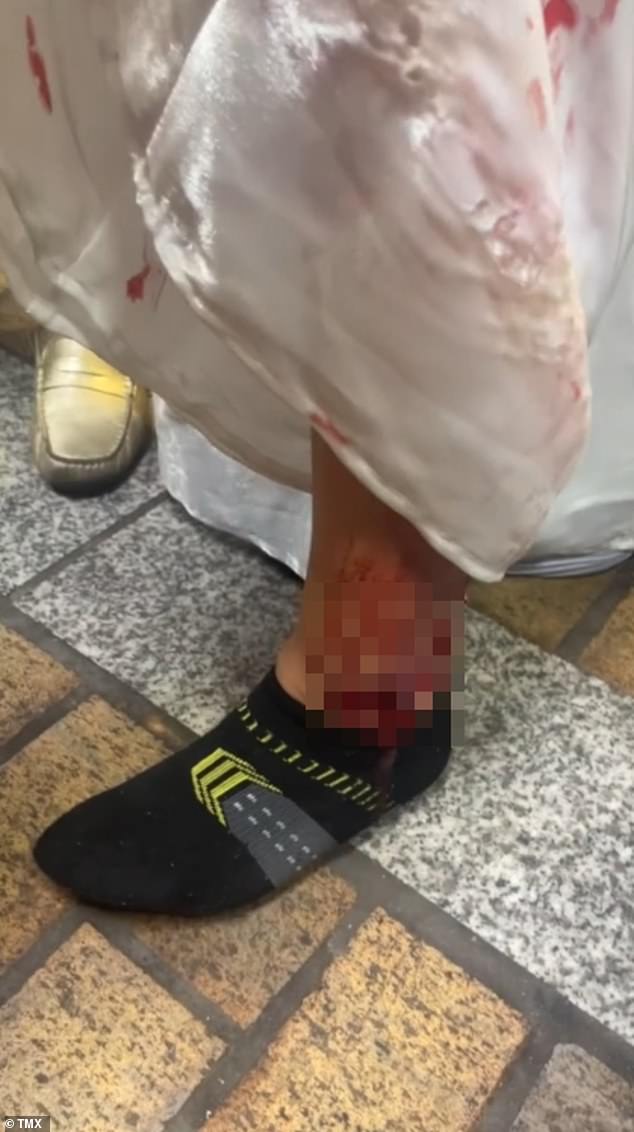 One particularly gruesome clip showed a person's leg that appeared to have been severely lacerated in the stampede as it oozed blood