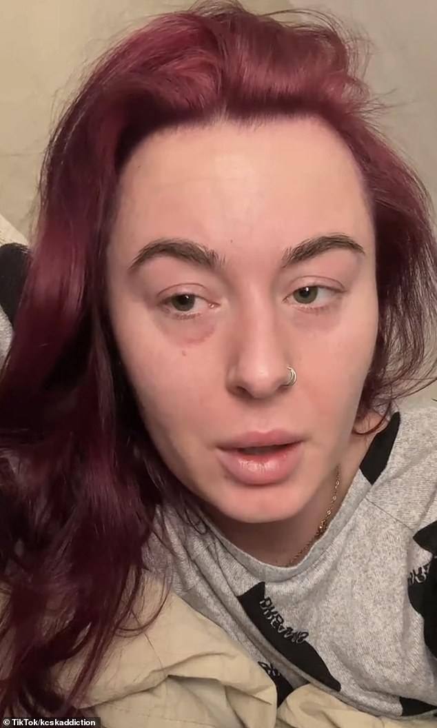 Speaking to the BBC , Casey Innalls, from Portsmouth, who has her own TikTo k account which details her experiences of withdrawing from the drug in a bid to help others
