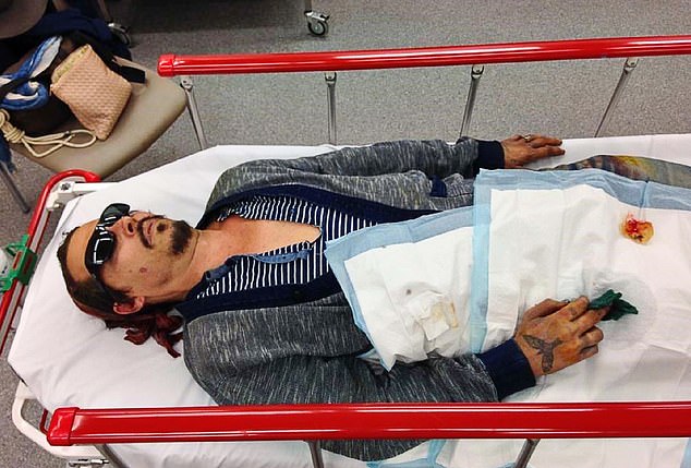 In A&E, Johnny (pictured), still wearing his sunglasses, lay on a stretcher, his bloody finger wrapped in a green napkin laid on top of a large fabric pad