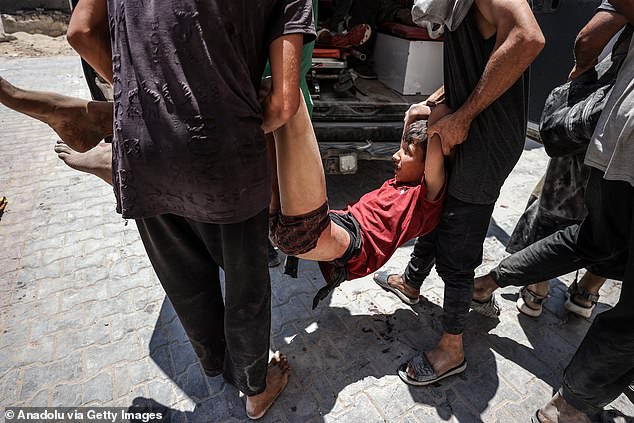 A young male Palestinian is transported to hospital to address his injuries after the shooting