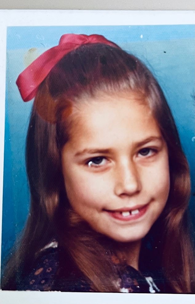 In my early teens, I had hideous and painful NHS train track braces to straighten my teeth, but even after they came off my teeth still protruded a little