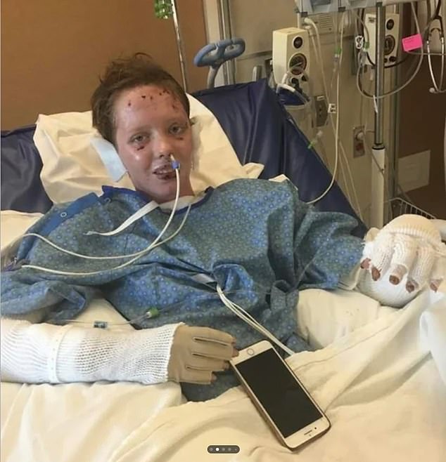 Social media users praised her as an 'absolute legend' and an 'effing warrior' in the comments section, with one person noting: 'Some of the toughest people have never battled what you have and come out the better. She is seen here after the accident in 2019