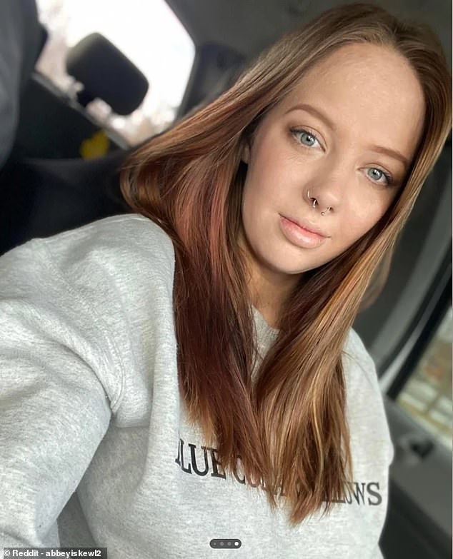 Since then, Abbey, now 23, has been documenting her physical transformation on her social media platforms as well as Reddit¿s ¿Made Me Smile¿ channel and recently shared her latest photographs taken nearly six years after the life-altering accident.